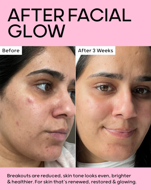 SCIENTIA AFTER FACIAL GLOW Resurfacing Mask & Restorative Serum Duo Set 65ml (peel) & 15ml (post-peel solution) مجموعة ثنائية من قناع تجديد البشرة والمصل المرمم 65 مل (مقشر) و15 مل (محلول ما بعد التقشير)