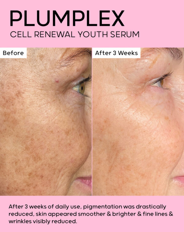 SCIENTIA PLUMPLEX Cell Renewal Youth Serum 30ml بلومبلكس مصل الشباب لتجديد الخلايا - Image 2