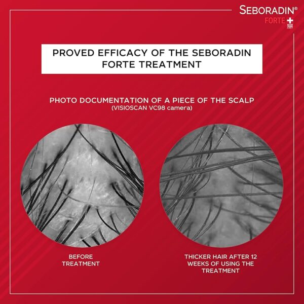 SEBORADIN Hair Mask Anti Hair Loss Treatment  150ml قناع الشعر سيبورادين لعلاج تساقط الشعر - Image 5