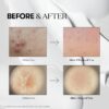 VT COSMETICS CICA Reedle Shot 300 Advanced Night Exosome, Microneedling Serum 50ml سيروم ليلي للبشرة - Image 5