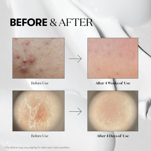 VT COSMETICS CICA Reedle Shot 300 Advanced Night Exosome, Microneedling Serum 50ml سيروم ليلي للبشرة - Image 5