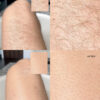 ANSWR EXFOLIATING HAIR REMOVAL DROP جهاز تقشير وازالة الشعر - Image 6