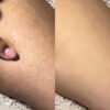 ANSWR EXFOLIATING HAIR REMOVAL DROP جهاز تقشير وازالة الشعر - Image 8