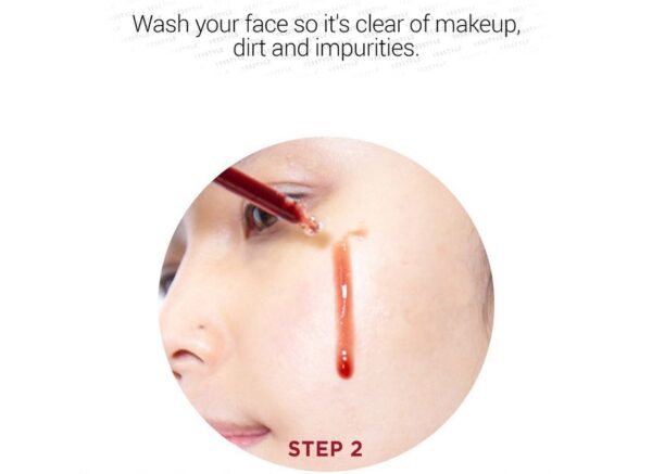SKIN 1004 - ZOMBIE BEAUTY Bloody Peel مقشر للبشرة - Image 2