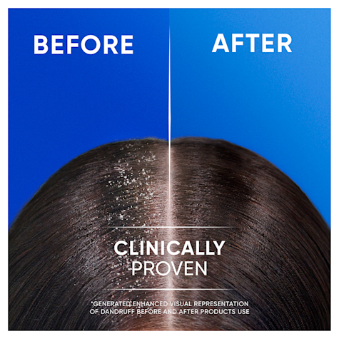 HEAD & SHOULDERS SMOOTH & SILKY SHAMPOO 400ml هيد أند شولدرز شامبو للشعر - Image 5