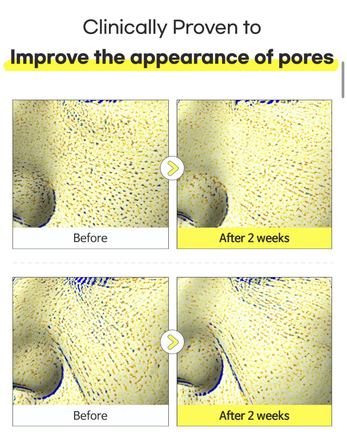 Tiam PORE MINIMIZING 21 SERUM سيروم تقليص المسام - Image 4