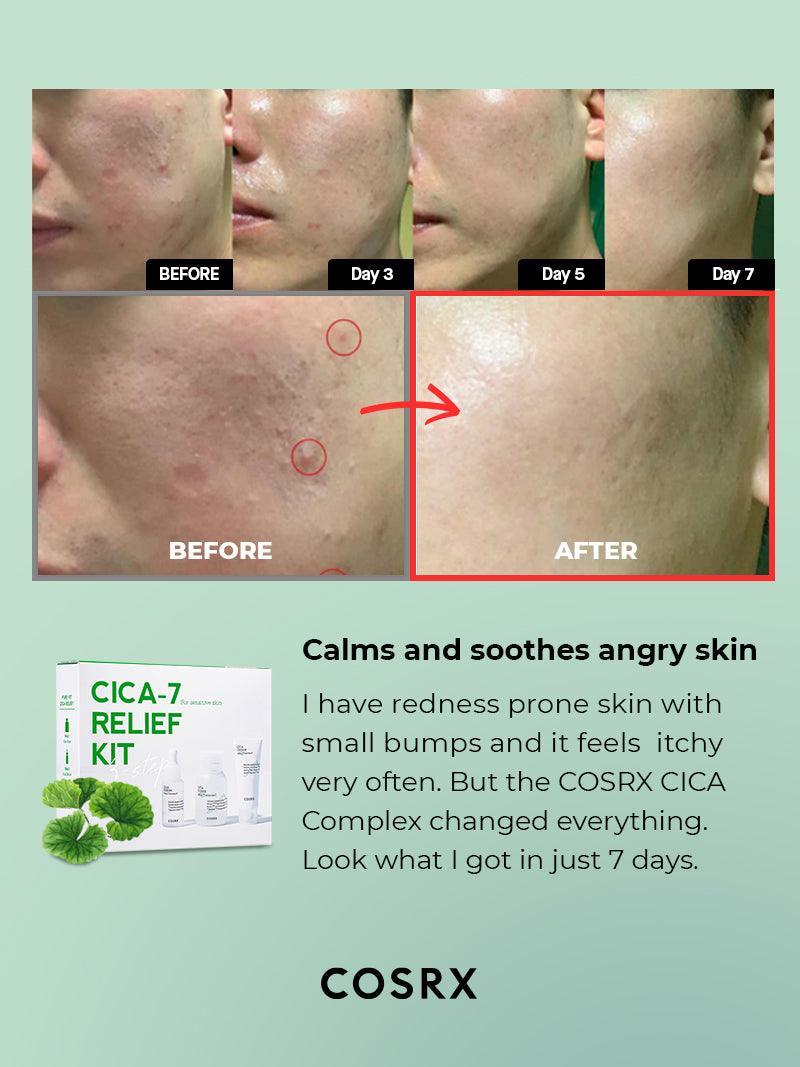 COSRX CICA-7 RELIEF KIT- 3 step مجموعة إغاثة بثلاث خطوات - Image 5