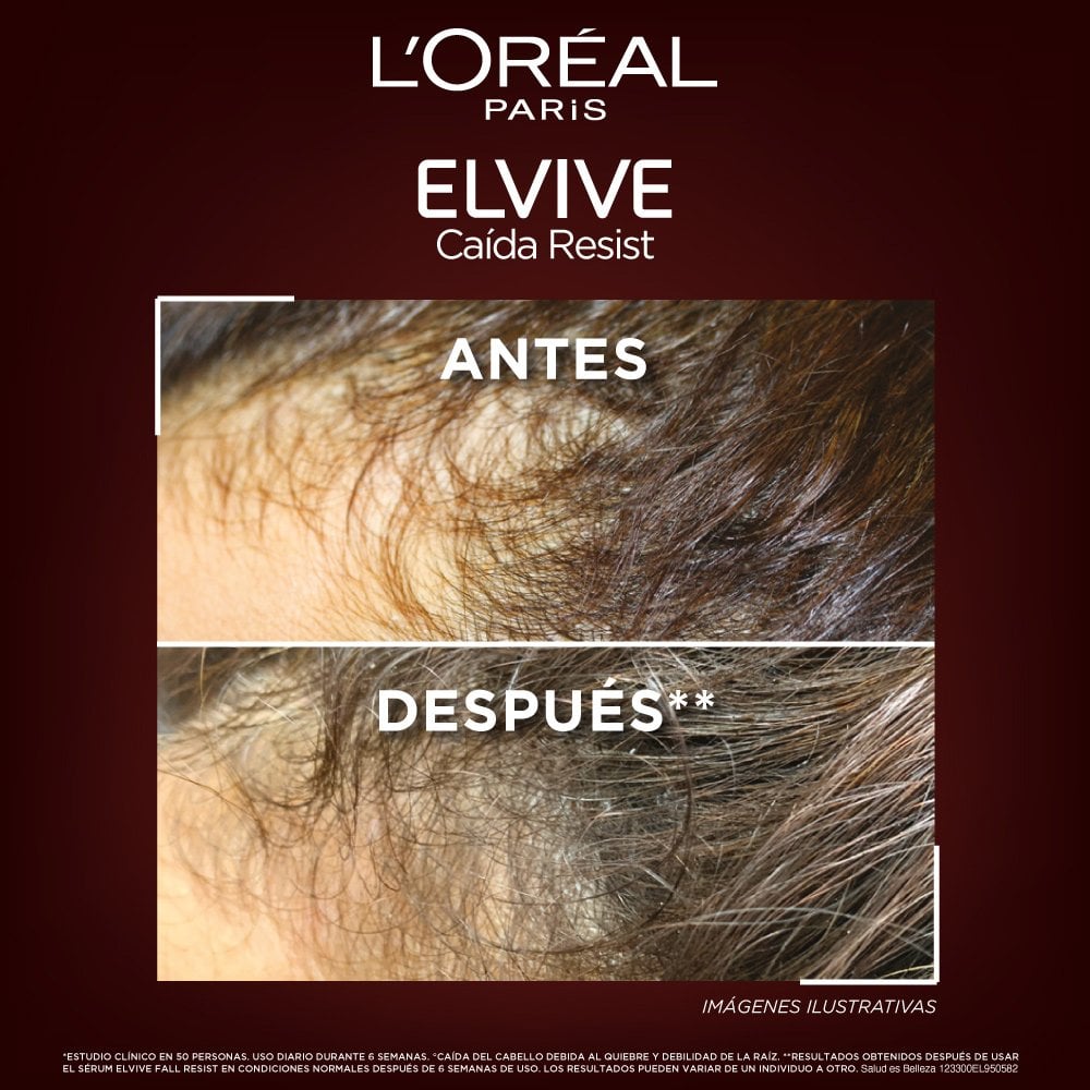 LOREAL ELVIVE FALL RESIST AMINEXIL SHAMPOO 370ml شامبو أمينيكسيل المقاوم للتساقط - Image 2