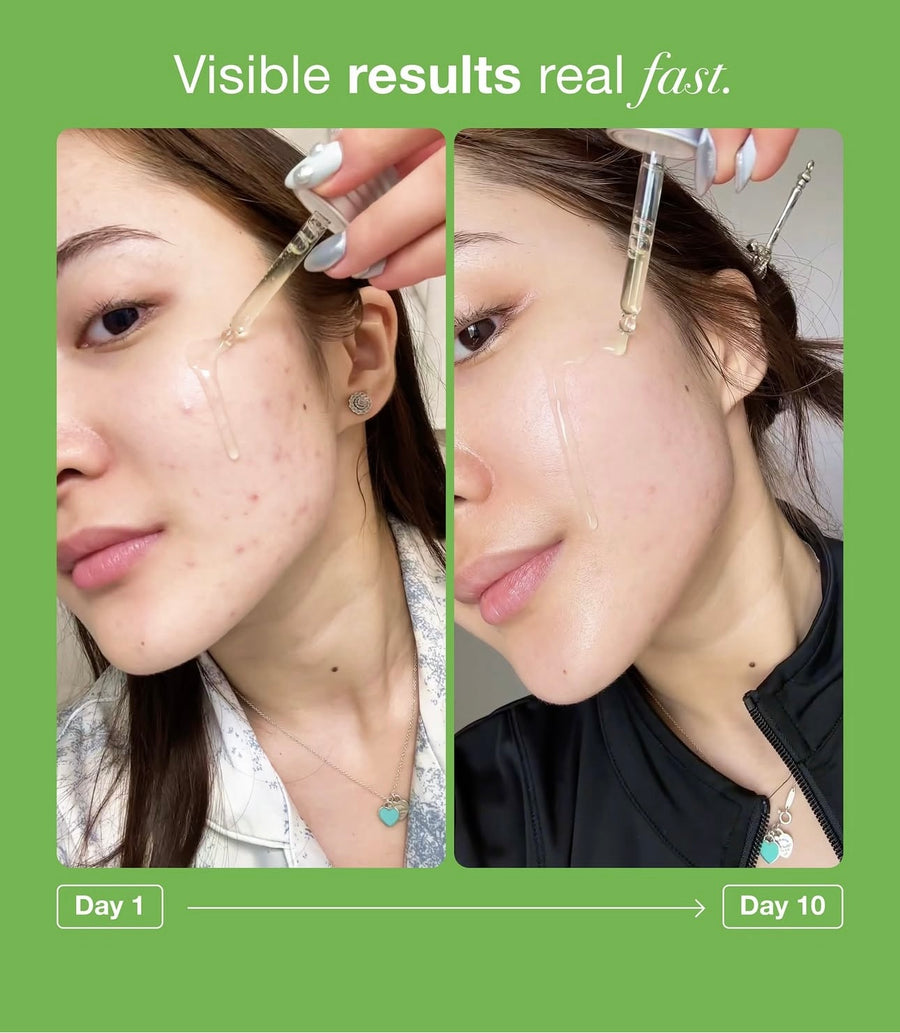 ANUA AZELAIC ACID 10 HYALURON REDNESS SOOTHING SERUM 30ML أنوا سيروم الآزليك اسيد المهدئ للبشرة - Image 6