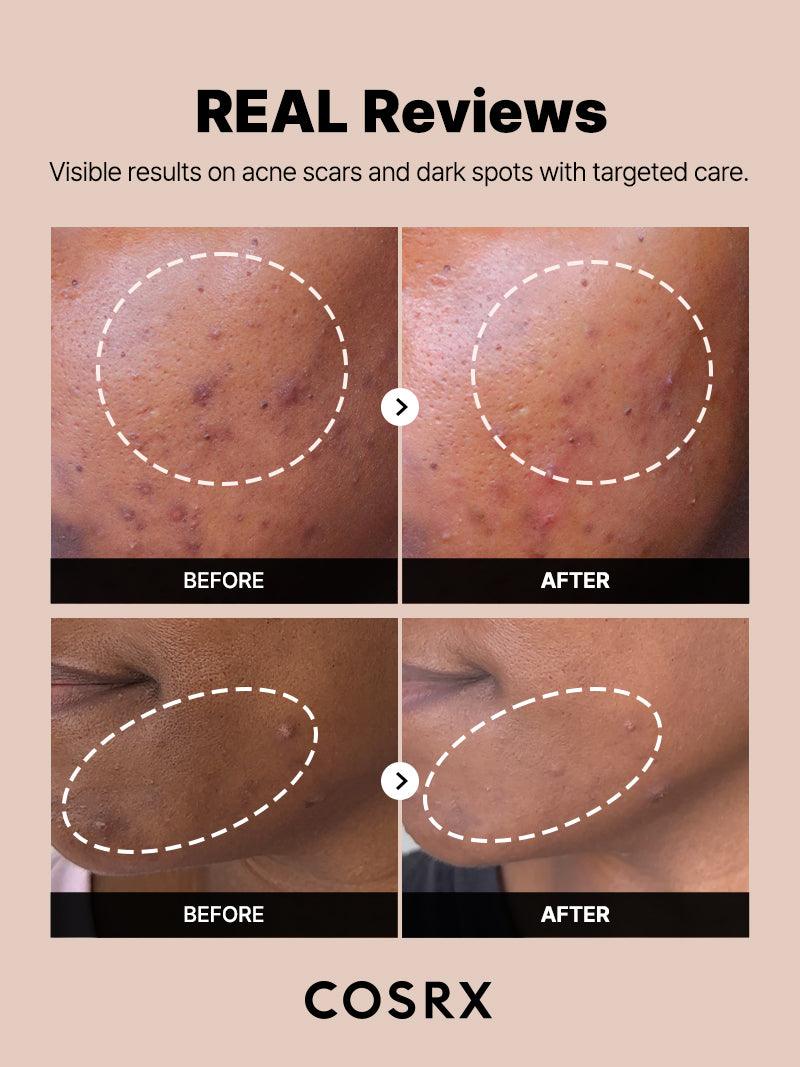 COSRX The Alpha-Arbutin 2 Discoloration Care Serum 50ml مصل ألفا أربوتين 2 للعناية بتغير اللون - Image 5