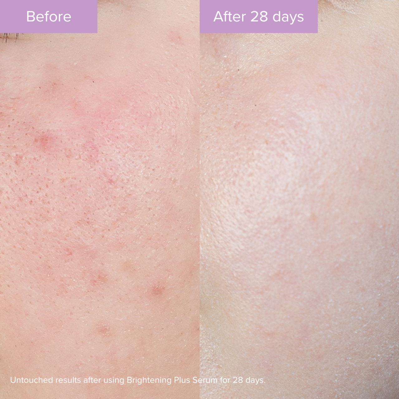 THE ORGANIC PHARMACY Brightening Plus Serum 35ml سيروم التفتيح بلس - Image 4