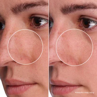 BENEFIT The Porefessional Shrink Wrap 50ml بنفت معالج ليلي مضاد للمسام - Image 4