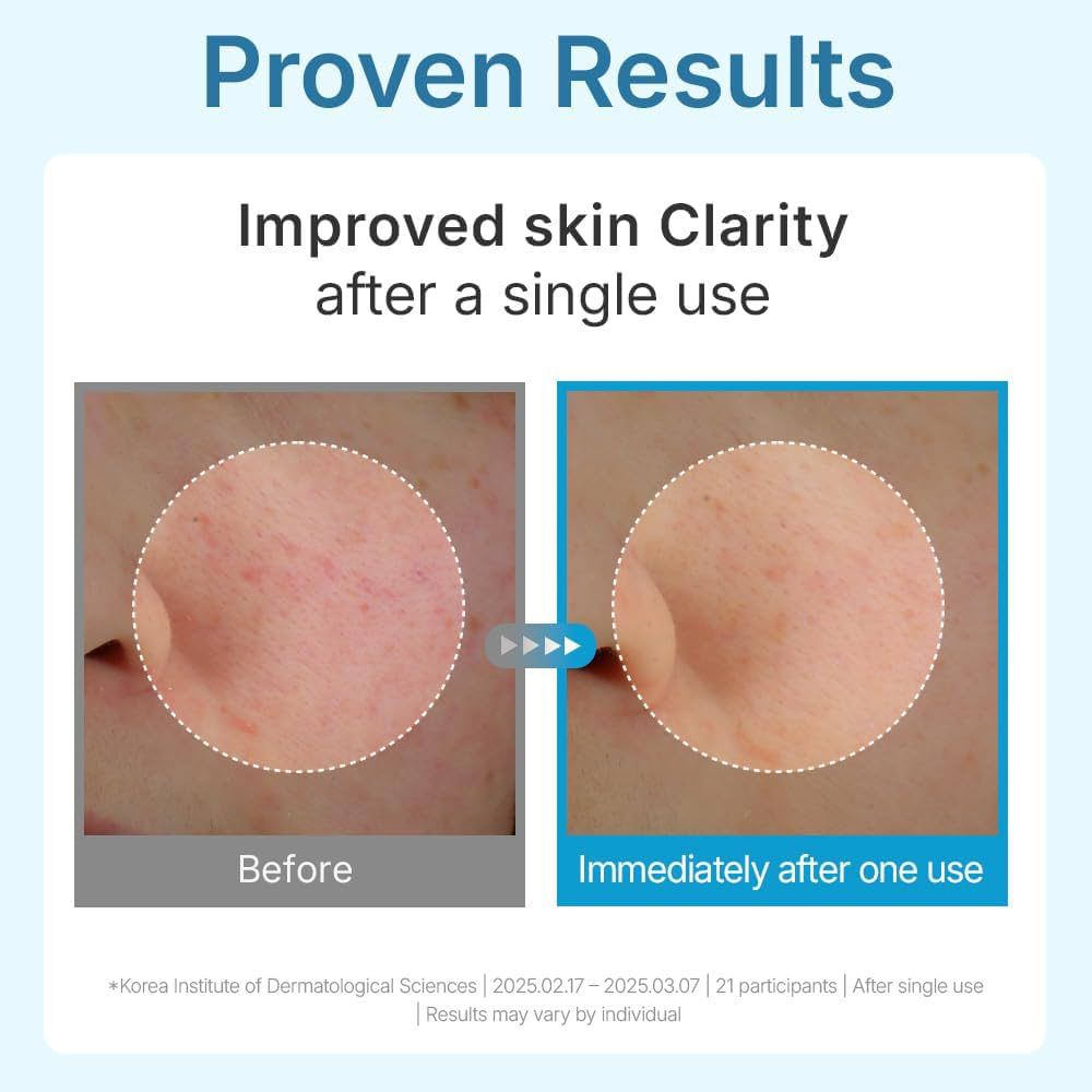 CENTELLIAN 24 MADECA LAB HYAL WATERFULL GLOW GEL MASK ماسك ورقي للبشرة من سنتليان - Image 4