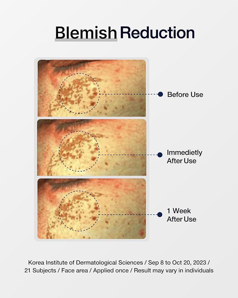 CENTELLIAN 24 EXPERT MADE CREAM RADIANCE BRIGHTENING & MOISTURE IMPROVEMENT كريم مرطب للبشرة من سنتليان - Image 2