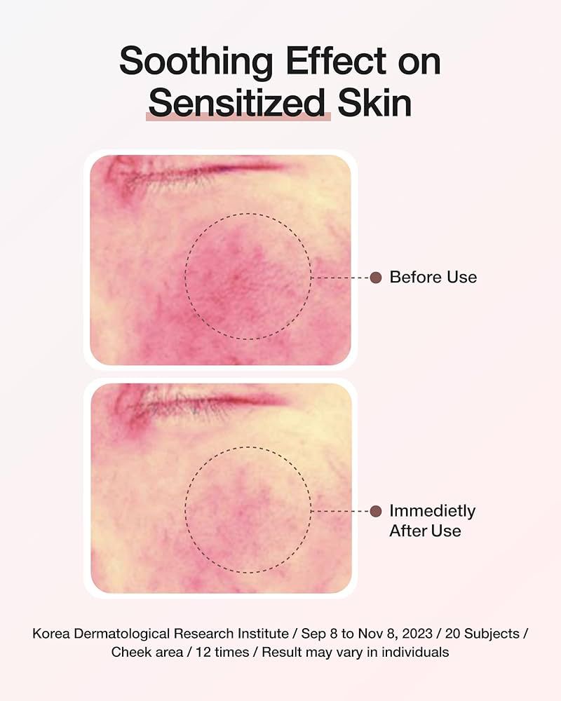 CENTELLIAN 24 EXPERT MADECA CREAM SIGNATURE كريم من سنتليان لمكافحة التجاعيد وتهدئة البشرة - Image 3