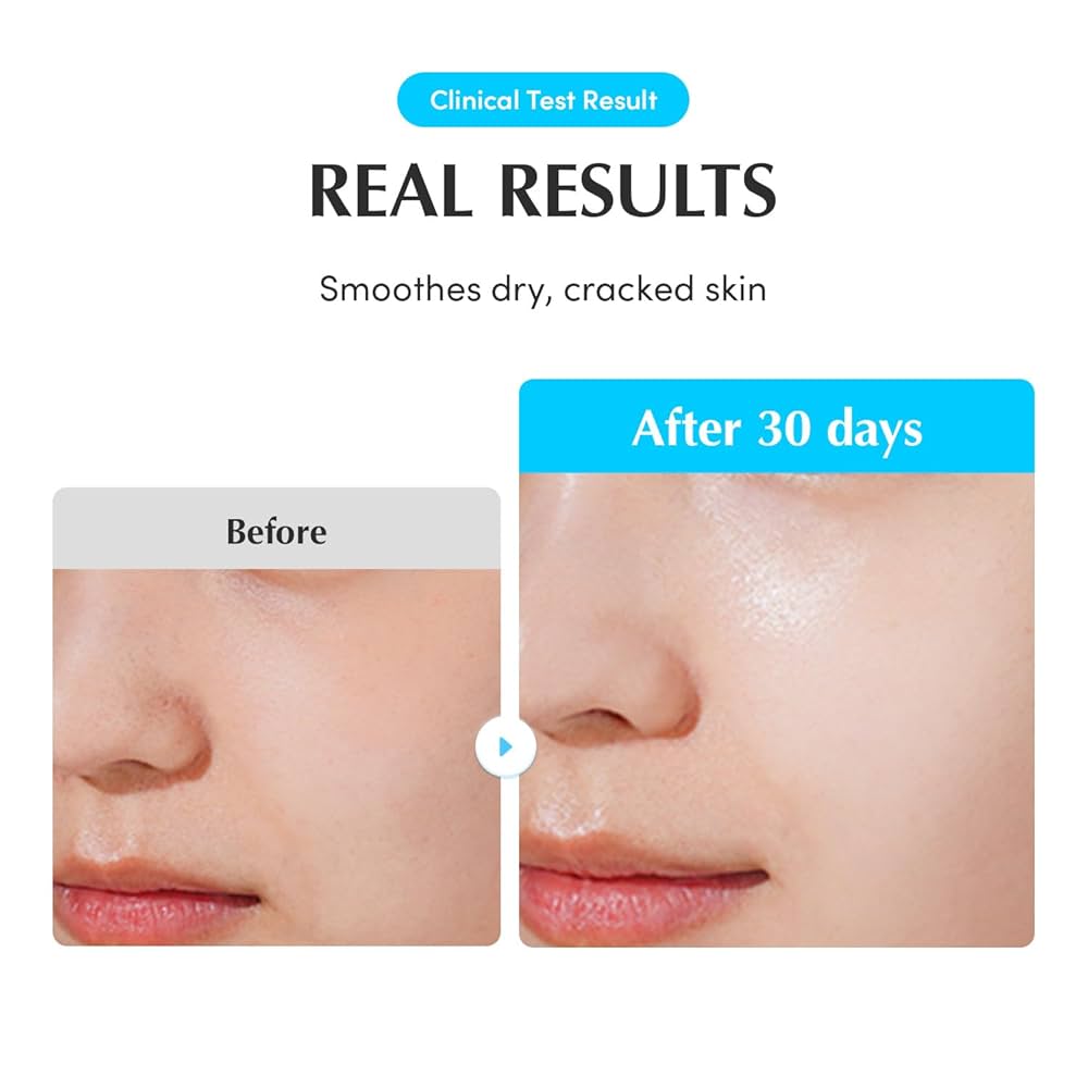 EQQUALBERRY Swimming Pool Ampoule 50ml سيروم حمض الهيالورونيك أسد للبشرة - Image 6