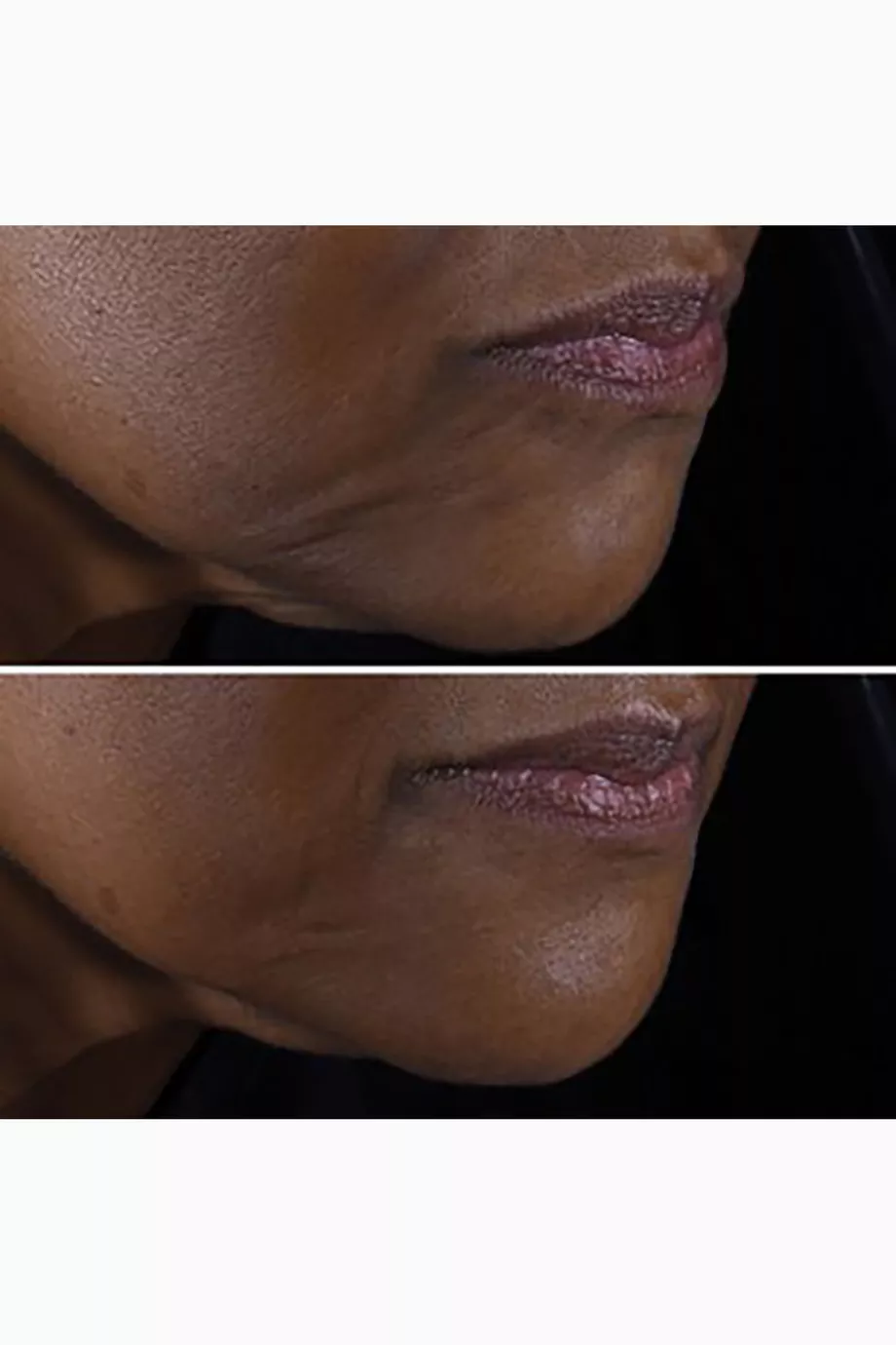 CLINIQUE Smart & Smooth: Smart Clinical Repair Set كلينك مجموعة إصلاح البشرة - Image 4