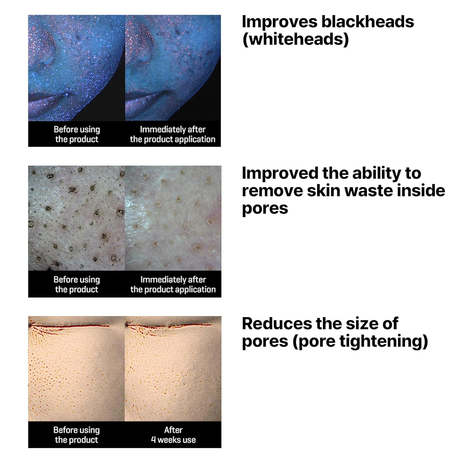 SOME BY MI Lacto Soy Sebum & Blackhead Cleansing Oil 200ml غسول زيتي للبشرة من سوم باي مي - Image 5