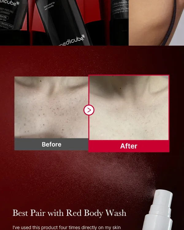MEDICUBE Red Acne Body Peeling Shot 110g رذاذ مقشر للجسم من ميديكيوب - Image 2