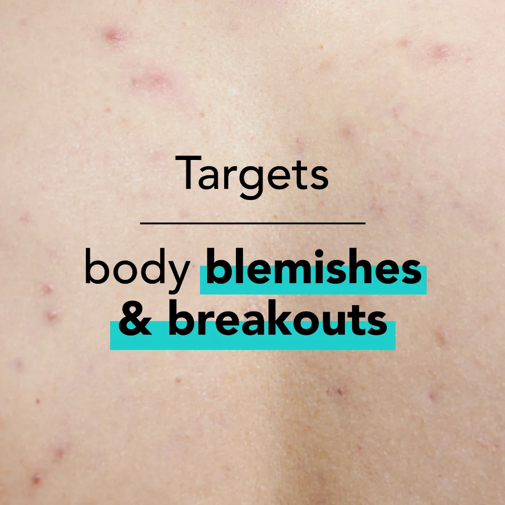 THE SOLUTION salicylic acid clear skin body gel 200ML جل مرطب للجسم بحمض الساليسيليك لتفتيح البشرة - Image 2