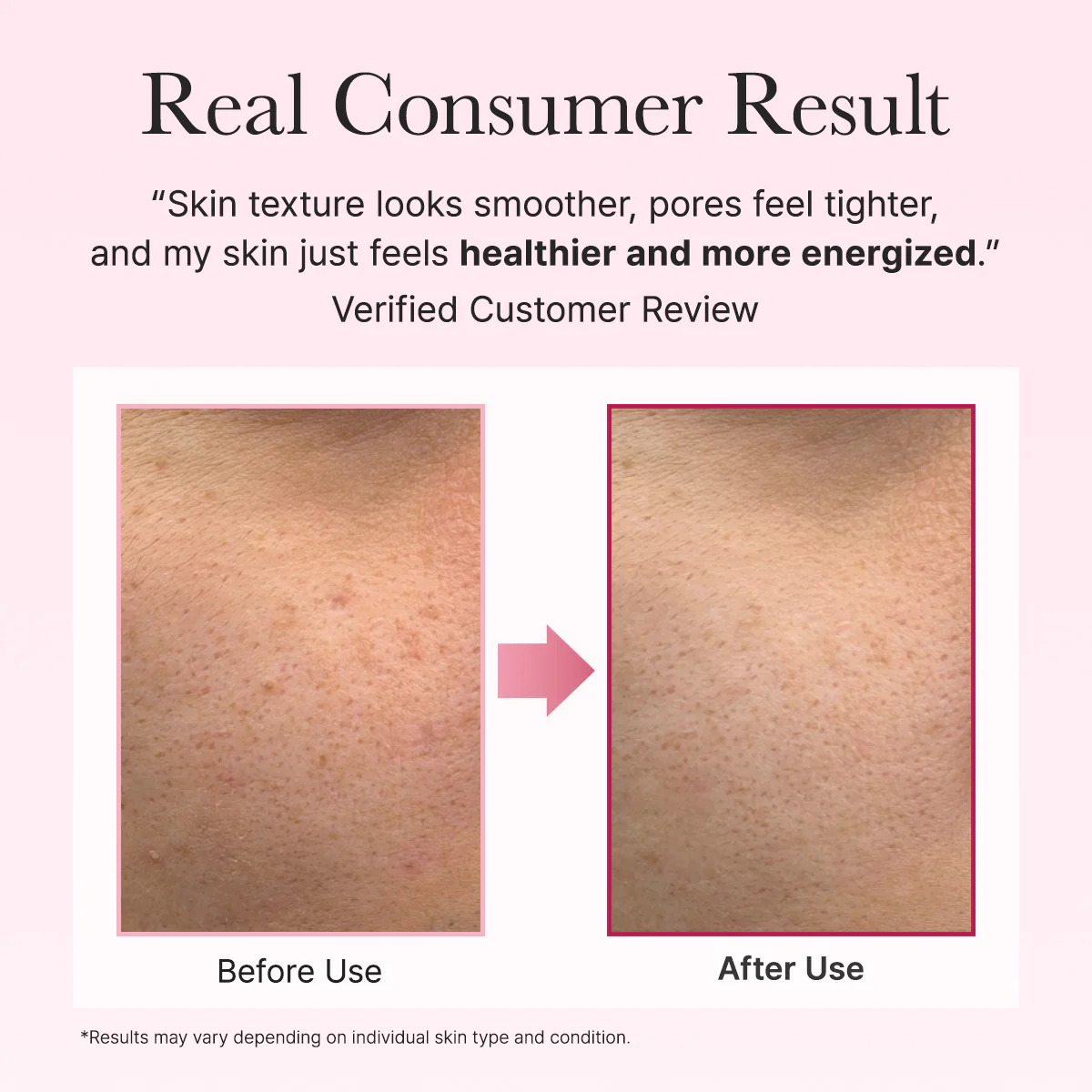 ARENCIA PDRN Booster Shot Face and Eye Moisturizer 30ml ارينسيا كريم مرطب يهدئ الاحمرار ،يقوي حاجز البشرة ويوحد لون البشرة - Image 8