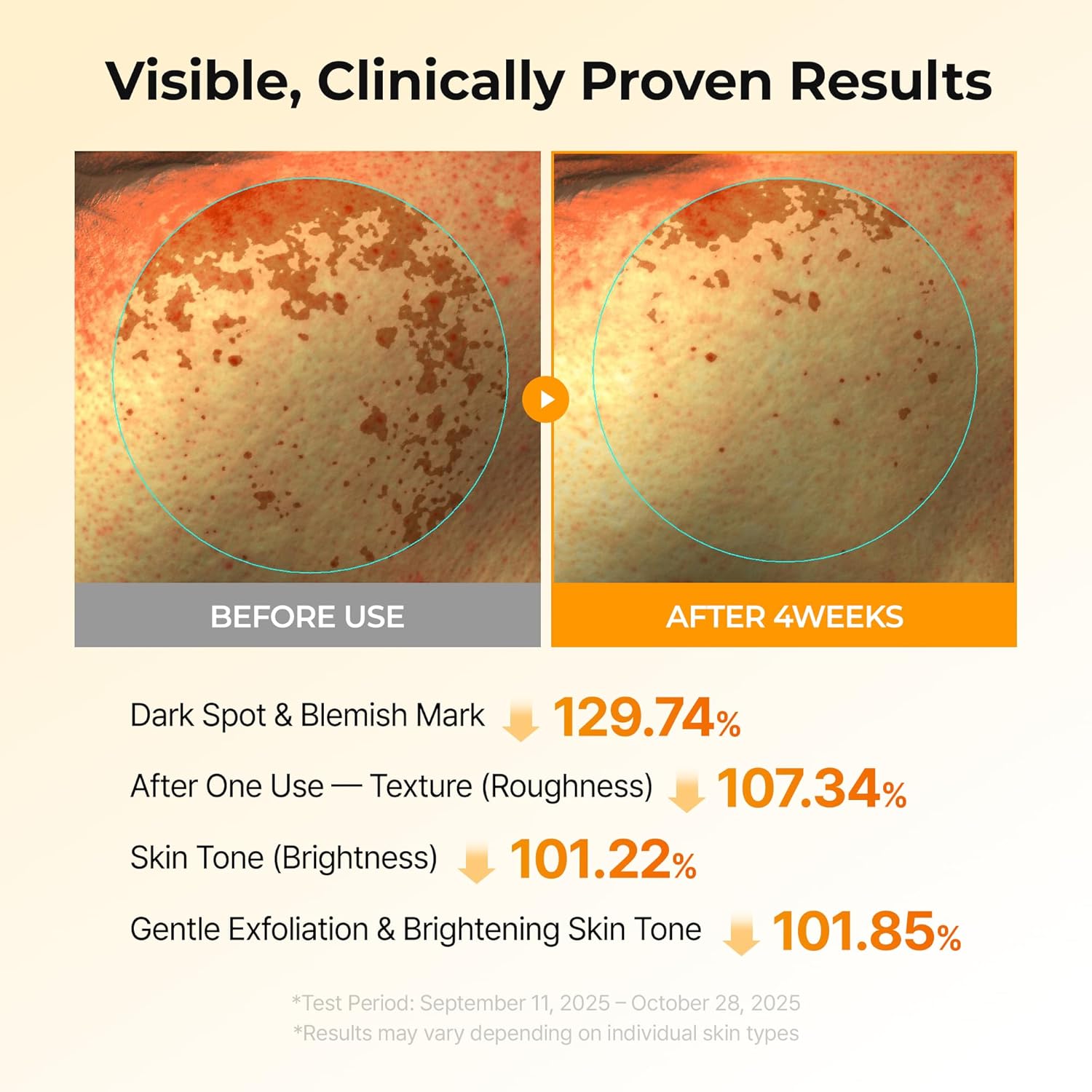 DR.MELAXIN TX-Kojic Acid Turmeric Toner Pad (70 Pads) دكتور ميلاكسين بادات تونر بالكركم وحمض الكوجيك تقشر ،ترطب وتوحد لون البشرة - Image 4