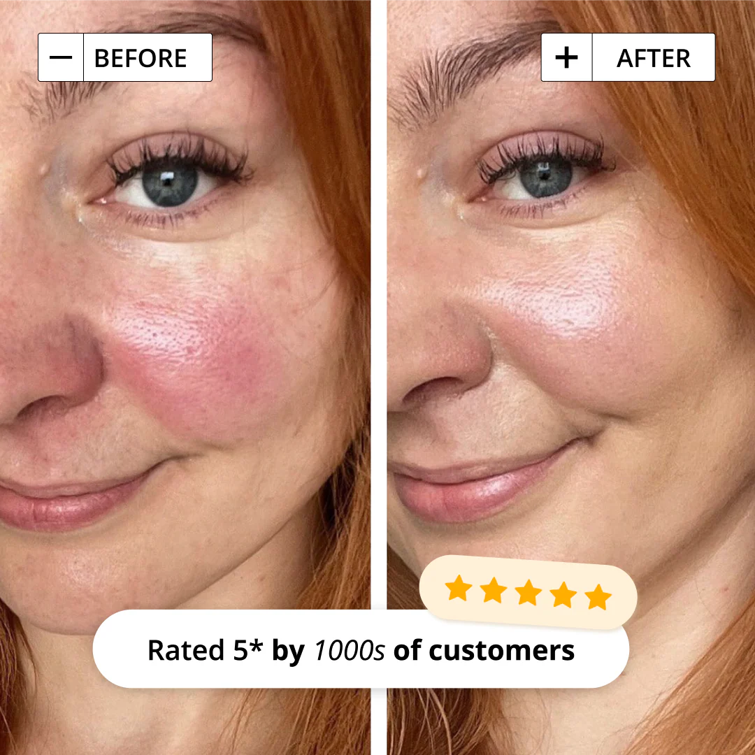 SORTED SKIN 5 IN 1 ANTI-REDNESS DAY CREAM SPF50 30ml سورتيد سكن كريم مرطب ومهدئ ومضاد لإحمرار البشرة مع عامل حماية من الشمس - Image 4