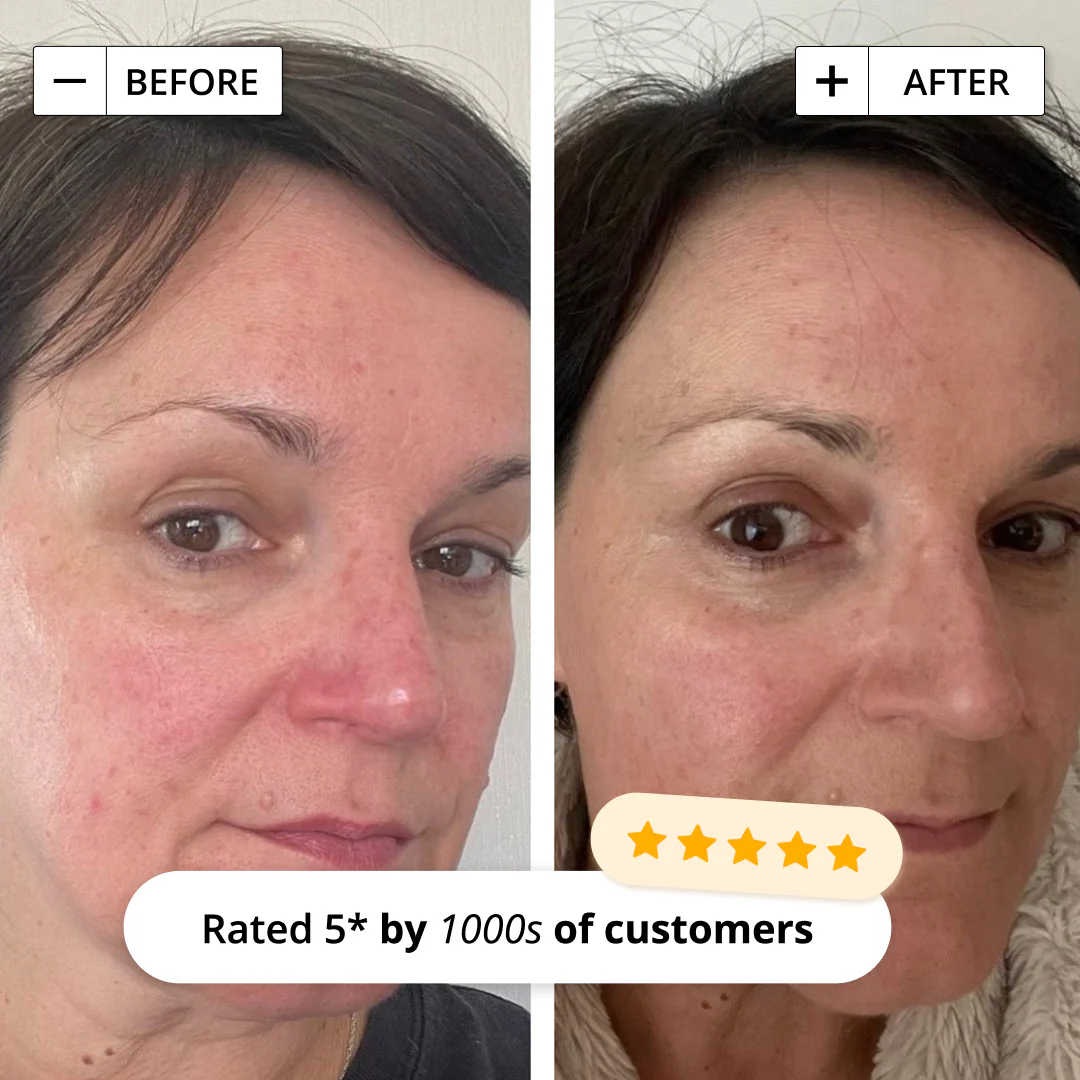 SORTED SKIN CALM & NOURISH LIQUID CLEANSING BALM FOR ALL SKIN TYPES 100ml سورتيد سكن غسول مرطب ينقي المسام ويعزز صحة البشرة مناسب لجميع انواع البشرة - Image 3