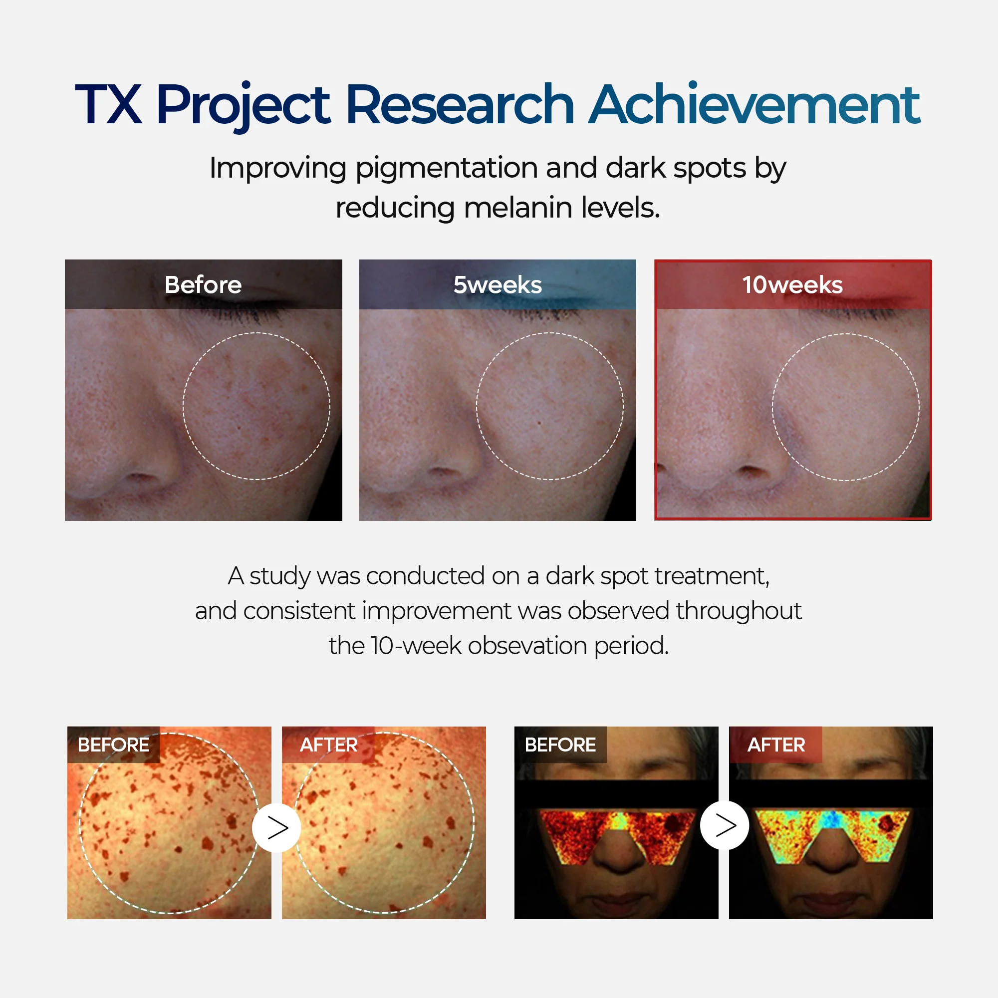 DR.MELAXIN TX Cream for Skin freckle, Blemishes, Anti-pigmetation 50ml دكتور ميلاكسين كريم يرطب بعمق يقلل التصبغات ويعزز من اشراقة البشرة - Image 6